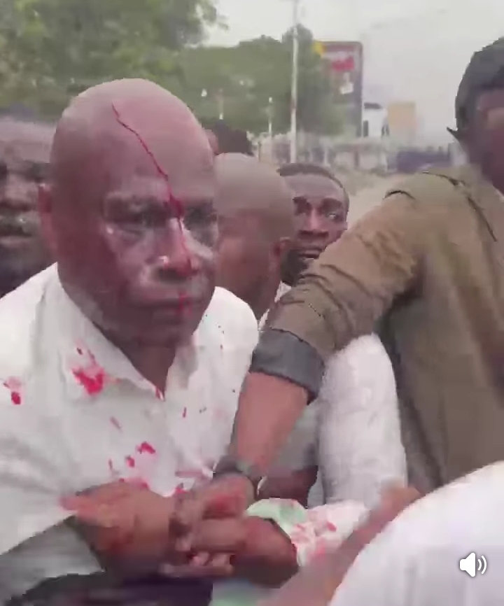 Kinshasa : Martin Fayulu blessé lors de la manifestation de la C64 contre le changement de la Constitution