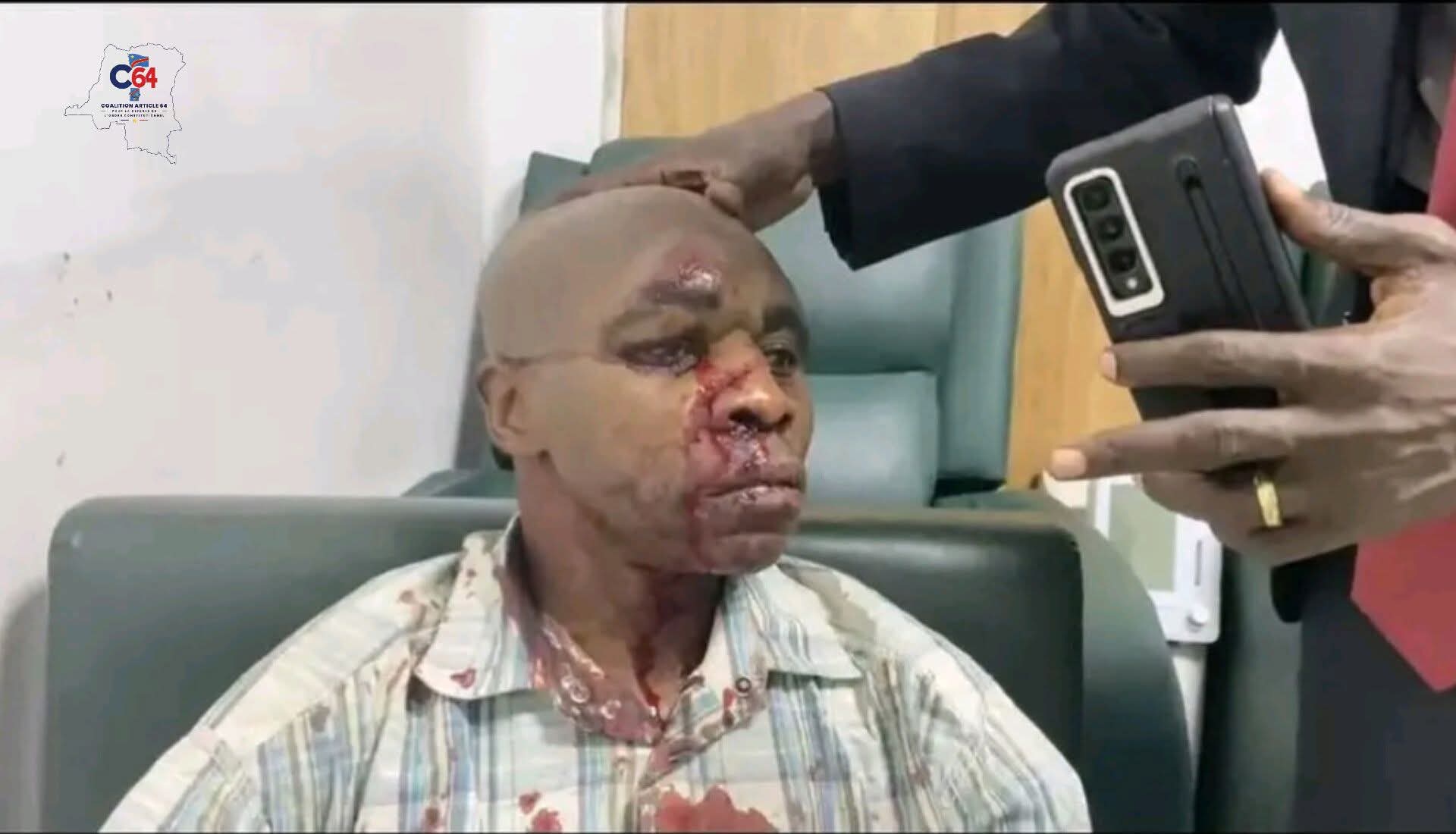 Kinshasa : Le cortège de Martin Fayulu attaqué devant le Palais de Justice, 3 blessés graves (Prince Epenge)